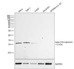 beta-2 Microglobulin Antibody in Western Blot (WB)