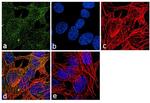 beta Tubulin Antibody in Immunocytochemistry (ICC/IF)