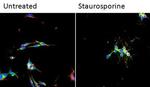 beta-3 Tubulin Antibody in Immunocytochemistry (ICC/IF)