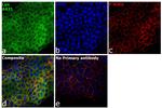 Lyn Antibody in Immunocytochemistry (ICC/IF)