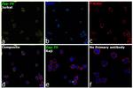 Zap-70 Antibody in Immunocytochemistry (ICC/IF)