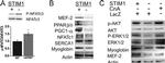 STIM1 Antibody in Western Blot (WB)