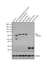 NEFL Antibody in Western Blot (WB)