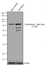 NEFL Antibody in Western Blot (WB)