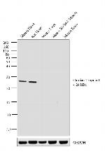 Cardiac Troponin I Antibody in Western Blot (WB)