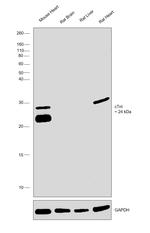 Cardiac Troponin I Antibody