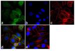 GRK2 Antibody in Immunocytochemistry (ICC/IF)