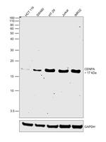 CENPA Antibody in Western Blot (WB)