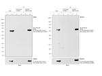 Myc Tag Antibody in Immunoprecipitation (IP)