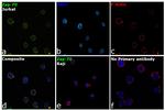 Zap-70 Antibody in Immunocytochemistry (ICC/IF)