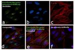 Transferrin Receptor Antibody in Immunocytochemistry (ICC/IF)