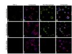 TGF beta-1 Antibody