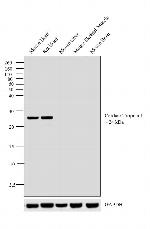 Cardiac Troponin I Antibody