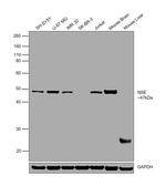 NSE Antibody