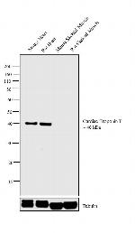 Cardiac Troponin T Antibody