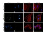 FGF2 Antibody in Immunocytochemistry (ICC/IF)