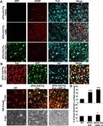 CHOP Antibody in Immunohistochemistry (IHC)