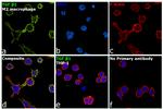 TGF beta-1 Antibody