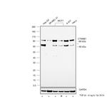 beta Catenin Antibody in Western Blot (WB)