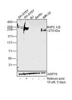 MAP2 Antibody in Western Blot (WB)