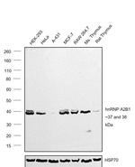 hnRNP A2B1 Antibody in Western Blot (WB)