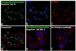 Estrogen Receptor alpha Antibody