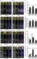 Cyclin D1 Antibody in Immunohistochemistry (IHC)