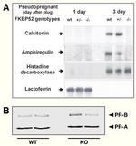 Progesterone Receptor Antibody in Western Blot (WB)