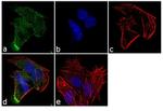 AKT3 Antibody in Immunocytochemistry (ICC/IF)