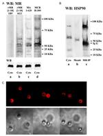 NR3C2 Antibody in Western Blot (WB)