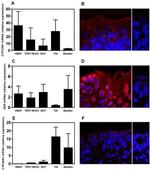 VDR Antibody in Immunocytochemistry, Immunohistochemistry (ICC/IF, IHC)