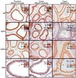 VDR Antibody in Immunohistochemistry (IHC)