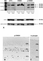 GRK1 Antibody in Western Blot (WB)