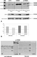 GRK1 Antibody in Western Blot (WB)