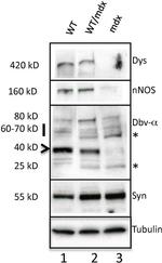 SNTB2 Antibody in Western Blot (WB)