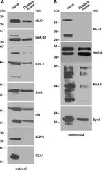 SNTB2 Antibody in Western Blot (WB)