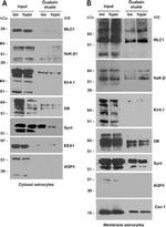 SNTB2 Antibody in Western Blot (WB)