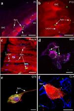 RAPSN Antibody in Immunocytochemistry (ICC/IF)