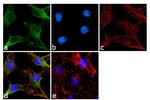 TIMP1 Antibody in Immunocytochemistry (ICC/IF)