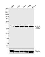 TIMP1 Antibody in Western Blot (WB)