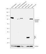 Transferrin Receptor Antibody in Western Blot (WB)