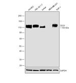 CD31 Antibody in Western Blot (WB)