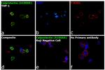 Calprotectin Antibody