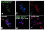 HLA-ABC Antibody