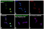 Calprotectin Antibody