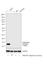 Calprotectin Antibody