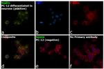 Nestin Antibody in Immunocytochemistry (ICC/IF)