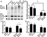 alpha Synuclein Antibody in Western Blot (WB)