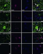 alpha Synuclein Antibody in Immunohistochemistry (IHC)