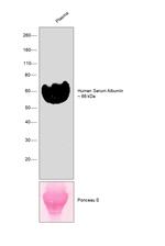 Human Serum Albumin Antibody in Western Blot (WB)